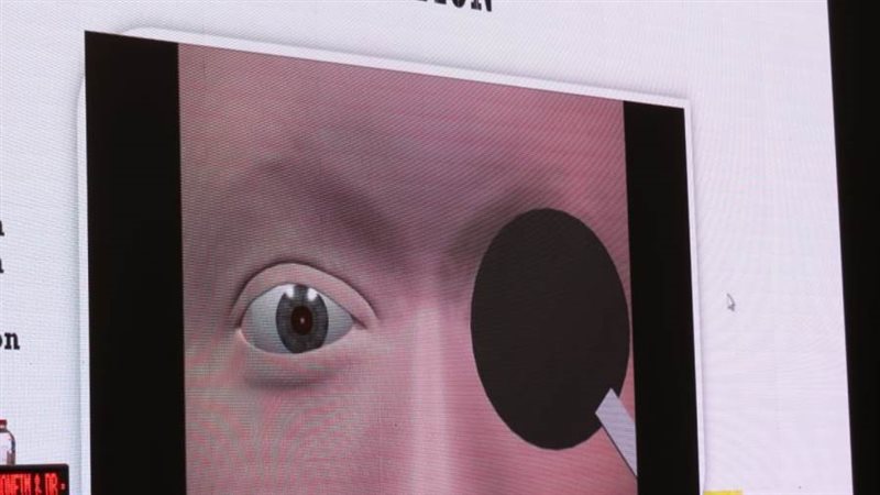 في مؤتمر رمد بورسعيد