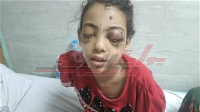 حبس المتهم بإطلاق النيران وإصابة 7 أشخاص فى حفل زفاف بالخانكة