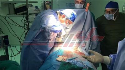 أورمان المنوفية : إجراء77 عملية جراحية للقلب لغير القادرين بالمجان