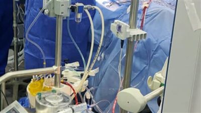 إجراء أول جراحة قلب مفتوح بأحد مستشفيات الصحة بالشرقية 