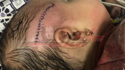 ”بالسنجة“.. أب يعتدي علي طفلته الرضيعة والأم: عاوزة حق بنتي