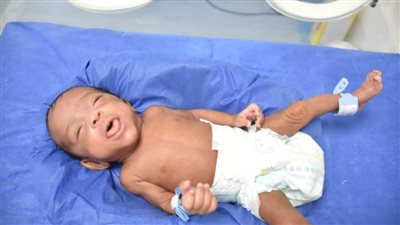في 74 يومًا.. هيئة الرعاية الصحية تنقذ حياة مولودة غير مكتملة الوزن بالأقصر