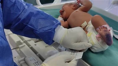 الصحة: فحص 26 ألف طفل ضمن المبادرة الرئاسية للكشف المبكر عن الأمراض الوراثية لحديثي الولادة