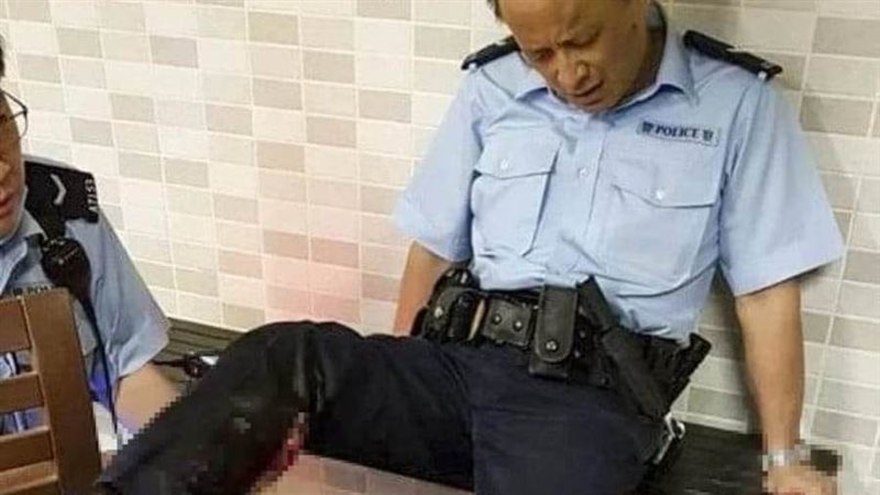 الضابط المصاب