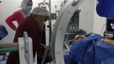 لأول مرة.. استخراج حصوة مرتجعة بمنظار الكلى بمستشفى السنبلاوين 