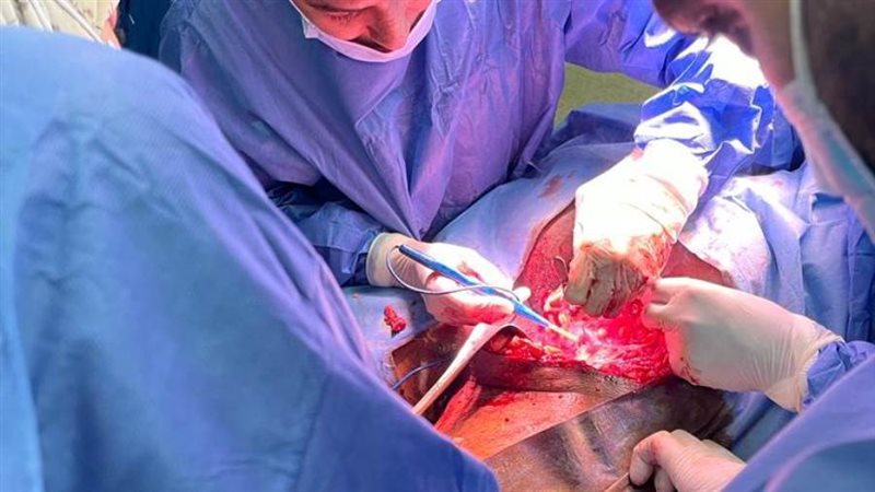 جانب من العملية لإزالة