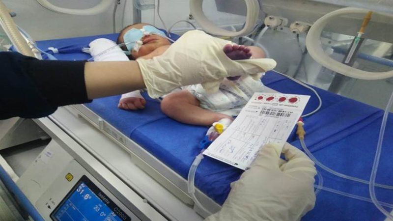 فحص الأطفال المبتسرين