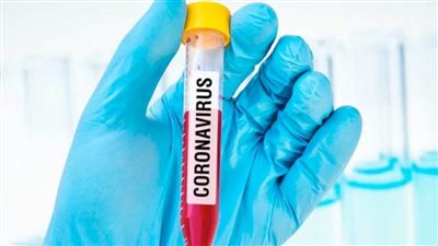 شخصيات سياسية فرنسية تضغط على الحكومة لعودة اختبارات كورونا المجانية