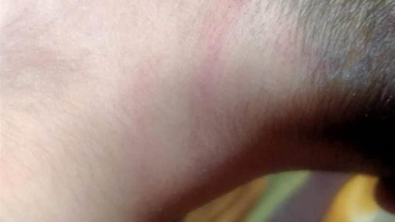 اثار التعدي على الطفل