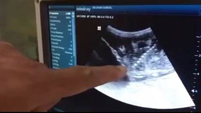 نجاح تلقيح صناعي لـ