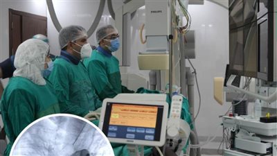 الرعاية الصحية: إنقاذ حياة رضيع بمستشفى النصر التخصصي ببورسعيد