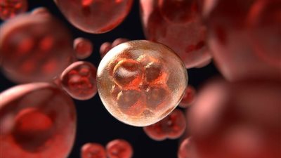 طبيبة بريطانية تكشف طريقة لتخفيض خطر الإصابة بالسرطان