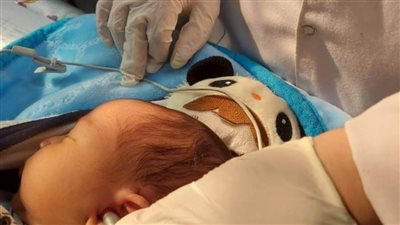 الصحة: فحص 2.467 مليون طفل بمبادرة اكتشاف وعلاج ضعف وفقدان السمع