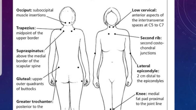 مواطن الالم