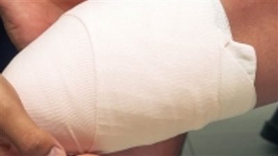 إصابة ربة منزل ببتر ساقها بسبب سقوطها أسفل قطار بشبين القناطر 