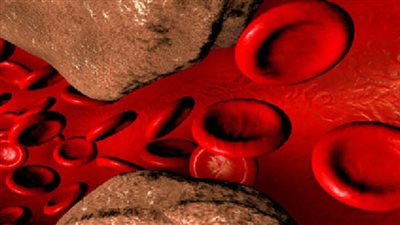 وجبة خفيفة يمكن أن تخفض الكوليسترول الضار في أيام بـ