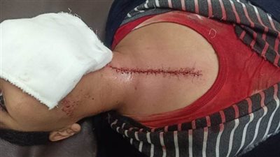 طالب بالصف السادس الابتدائي يعتدي على زميله بـ