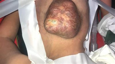 المريض المصري يجنى ثمار تطوير مستشفى أحمد ماهر التعليمي