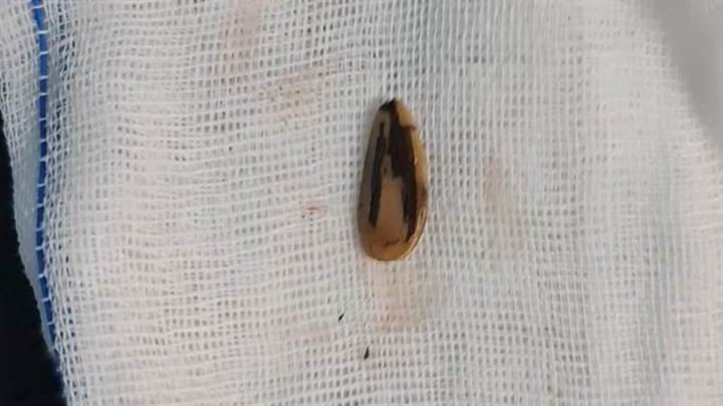 لبة بعد استخراجها