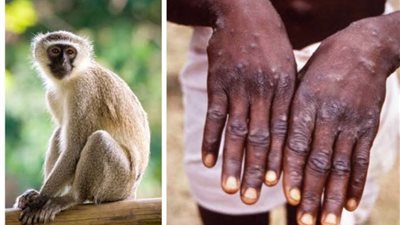 الصحة العالمية تكشف حقيقة صادمة عن 