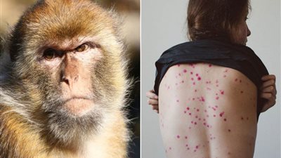 الصحة العالمية: تأكيد 92 إصابة 