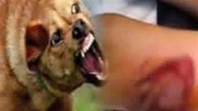 مصرع طفل بسبب عضة كلب في ”المنوفية“