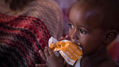 الأمم المتحدة تحذر من تفاقم أزمة الجوع في أجزاء من العالم