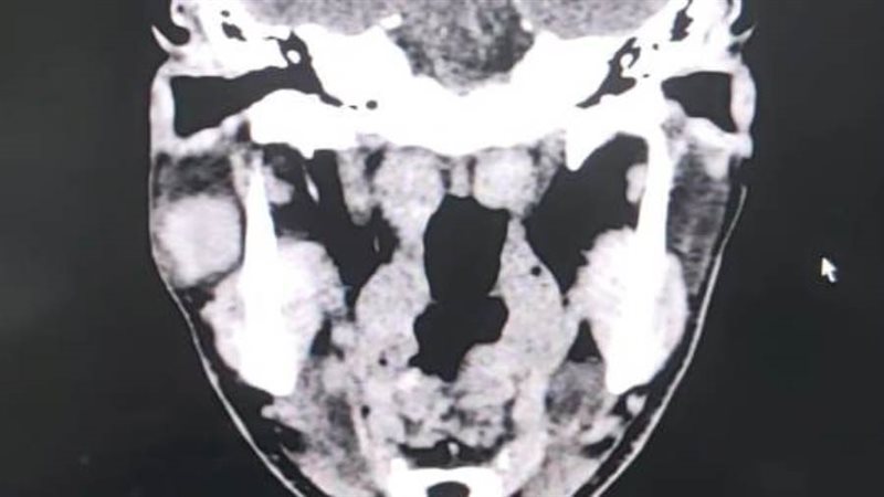 نجاح مستشفى ادكو