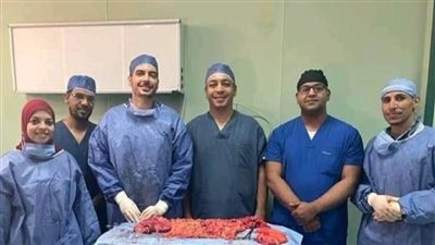 استئصال جذري لورم بالقولون الهابط لمريضة بقنا الجامعي