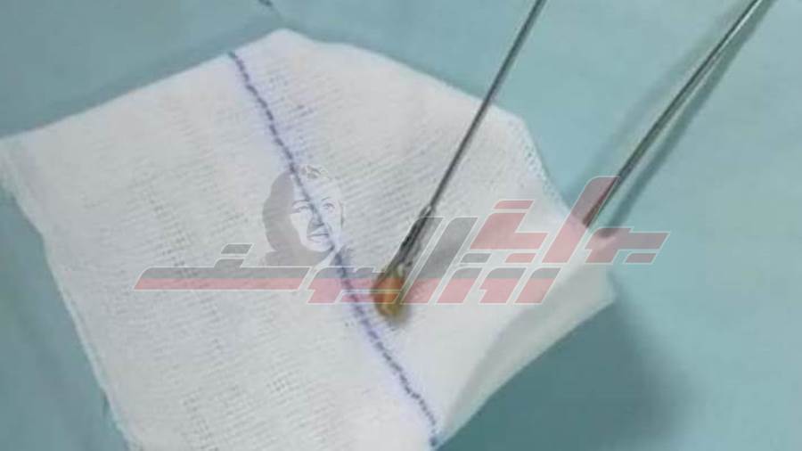 البذرة بعد استخراجها