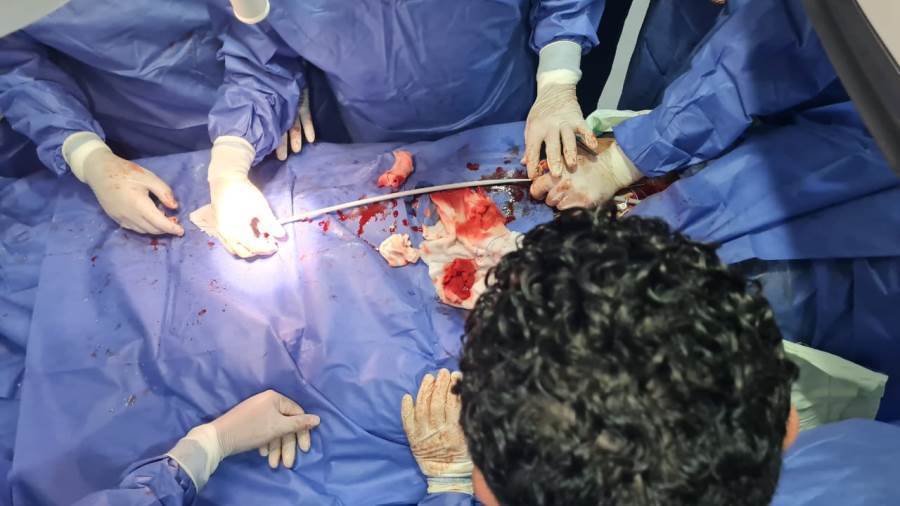 إجراء العملية