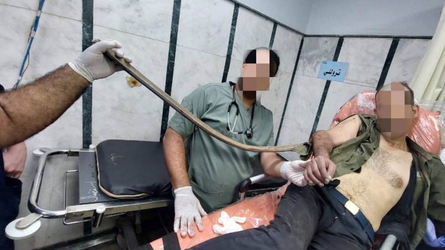 سيخ حديدى يخترق ذراعه